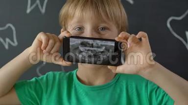 一个奶牙缺失的小男孩的特写镜头显示了他的x光<strong>牙齿图片</strong>。 儿童换牙的概念